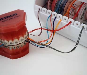 Tratamentos dentária